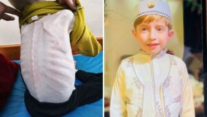 أطفال غزة يتضورون جوعا حتى الموت.. فادي الزنط يتحول إلى هيكل عظمي ووالدته تناشد لانقاذه