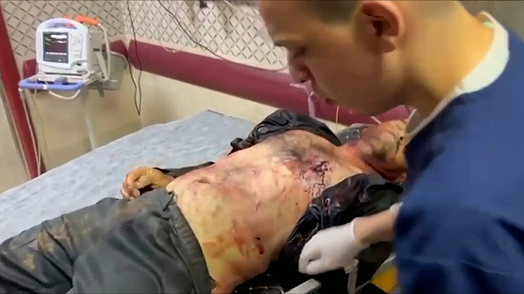 شهيد بنابلس ومصابان من الشاباك في عملية قرب مستوطنة ببيت لحم