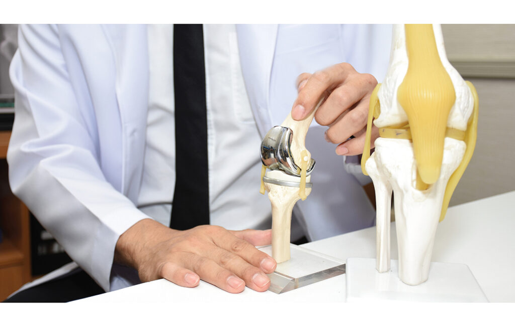 5000 عملية تبديل مفصل سنوياً في الإمارات 60% منها لمرضى السياحة العلاجية
