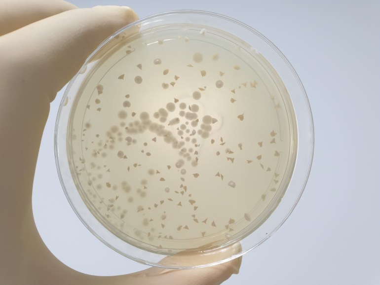 results of microbial culture of saccharomyces boulardii