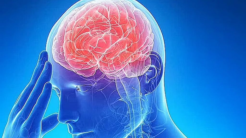 فهد الطبية توضح أعراض السكتة الدماغية وعوامل خطر الإصابة بها