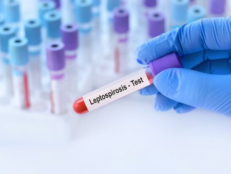 تعرّف على داء البريميات