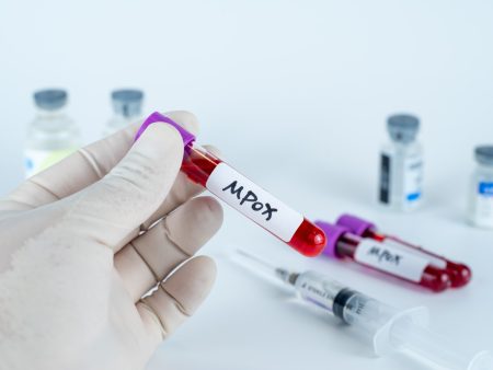 أفريقيا ترفع حالة الطوارئ الصحية بشأن جدري القردة بعد تراجع الإصابات