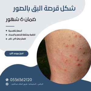 مكافحة بق الفراش: أسباب الانتشار وأحدث التقنيات والمبيدات المستخدمة